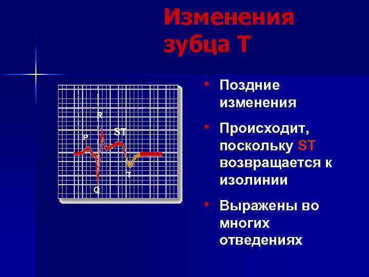 Изменения зубца T • Поздние изменения R ST P T Q • Происходит, поскольку