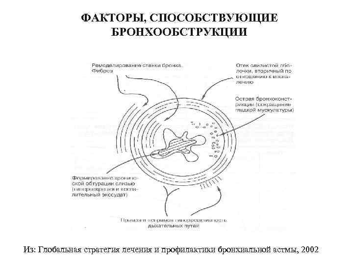    ФАКТОРЫ, СПОСОБСТВУЮЩИЕ   БРОНХООБСТРУКЦИИ Из: Глобальная стратегия лечения и профилактики