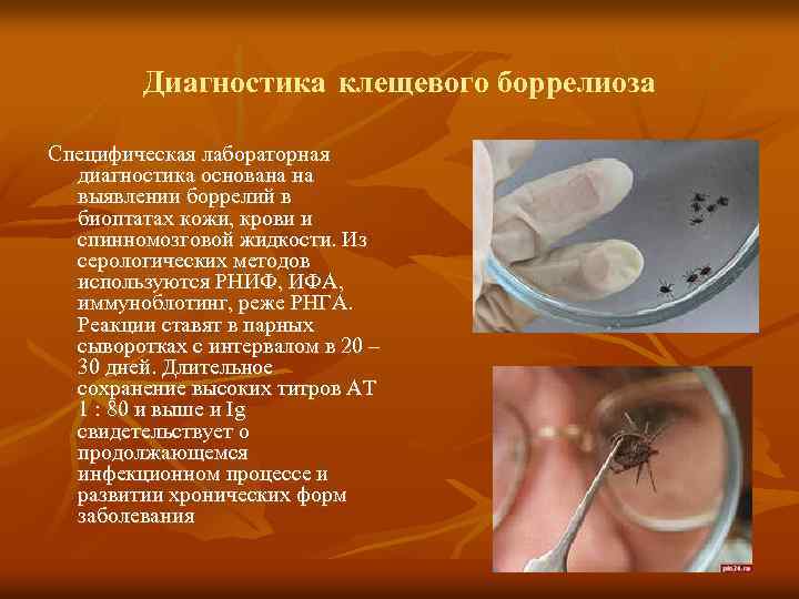 Диагностика клещевого боррелиоза Специфическая лабораторная диагностика основана на выявлении боррелий в биоптатах кожи, крови