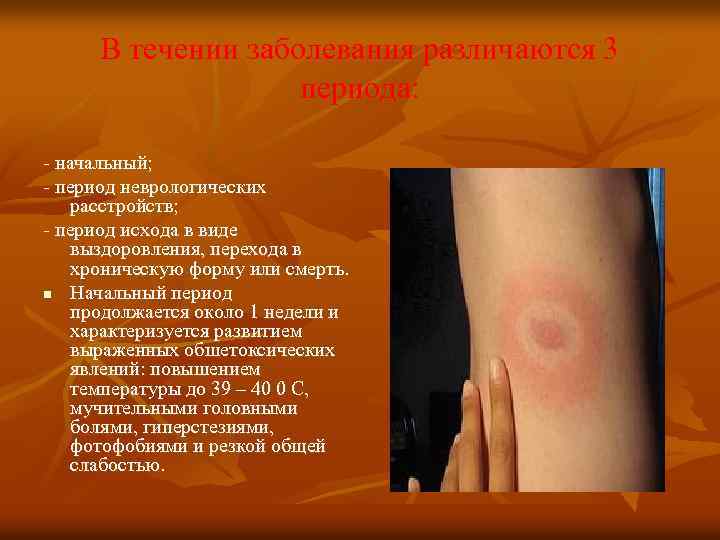 В течении заболевания различаются 3 периода: - начальный; - период неврологических расстройств; - период