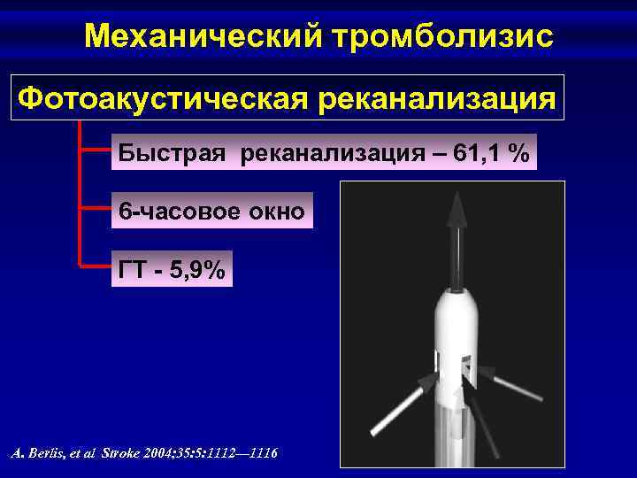 Механический тромболизис Фотоакустическая реканализация Быстрая реканализация – 61, 1 % 6 -часовое окно ГТ