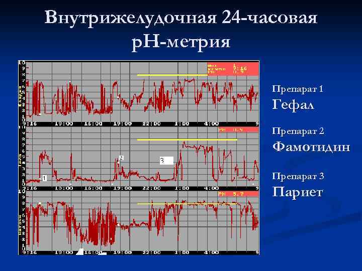Внутрижелудочная 24 -часовая р. Н-метрия Препарат 1 Гефал Препарат 2 Фамотидин Препарат 3 Париет