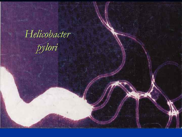 Helicobacter pylori 