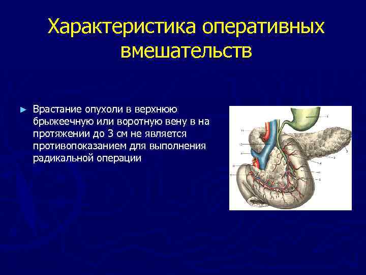 Характеристика оперативных вмешательств ► Врастание опухоли в верхнюю брыжеечную или воротную вену в на