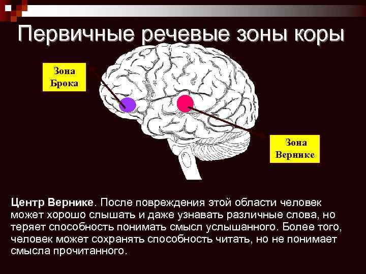 Первичные речевые зоны коры Зона Брока Зона Вернике Центр Вернике. После повреждения этой области