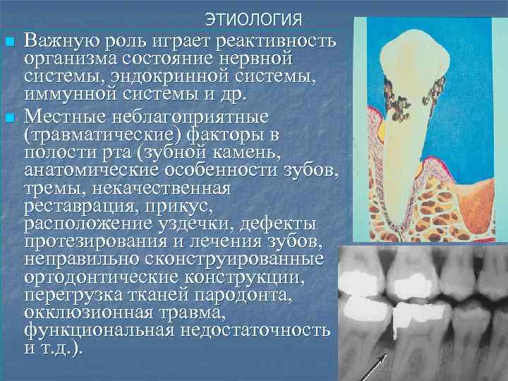 ЭТИОЛОГИЯ n n Важную роль играет реактивность организма состояние нервной системы, эндокринной системы, иммунной