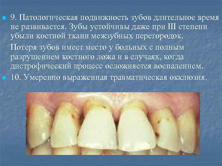 n n 9. Патологическая подвижность зубов длительное время не развивается. Зубы устойчивы даже при