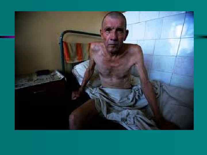 СПИД 3 стадия: воспаление легких, опухоли, туберкулез, потеря зрения, слуха, кишечные инфекции, невозможность проглотить