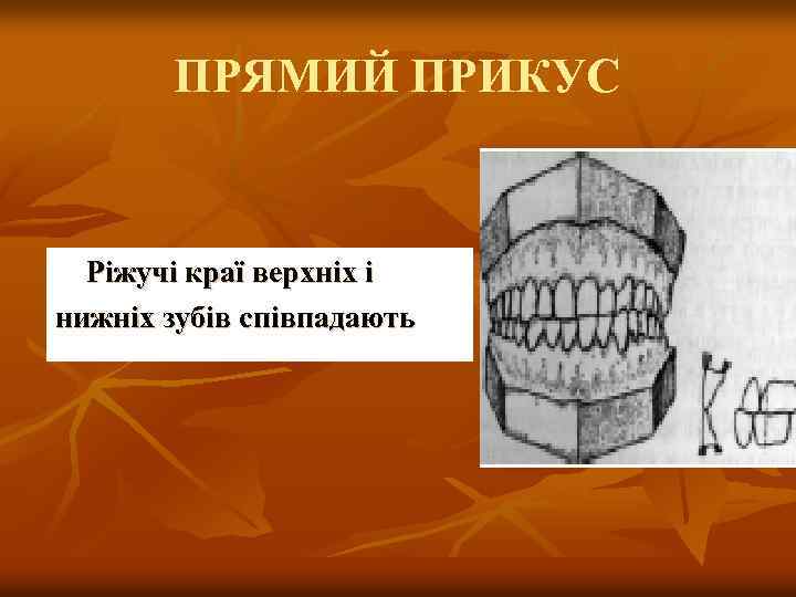 ПРЯМИЙ ПРИКУС Ріжучі краї верхніх і нижніх зубів співпадають 