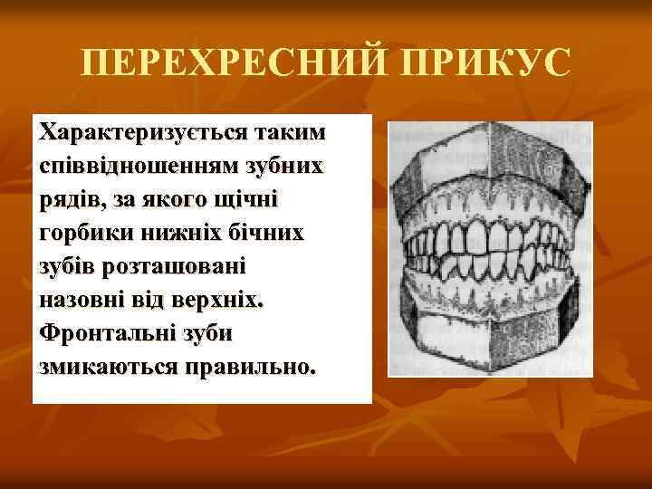 ПЕРЕХРЕСНИЙ ПРИКУС Характеризується таким співвідношенням зубних рядів, за якого щічні горбики нижніх бічних зубів