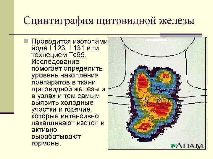 Что такое сцинтиграфия щитовидной железы