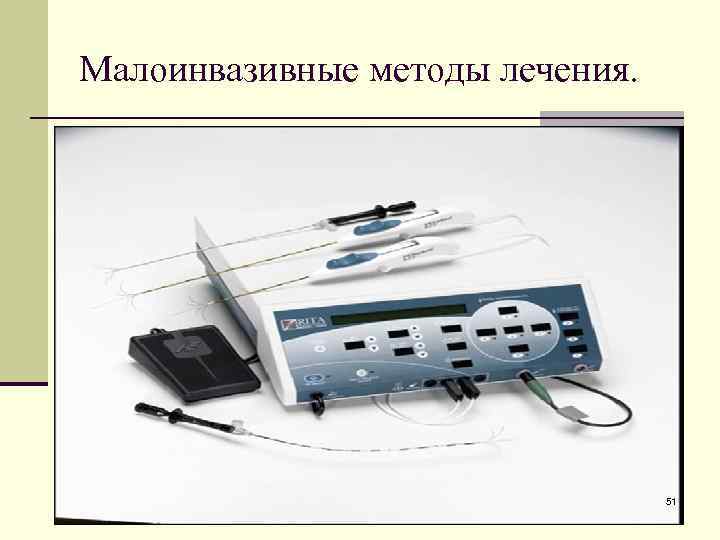 Малоинвазивные методы лечения. 51 
