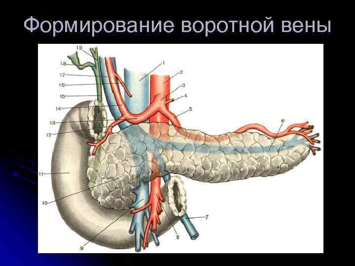 Формирование воротной вены 