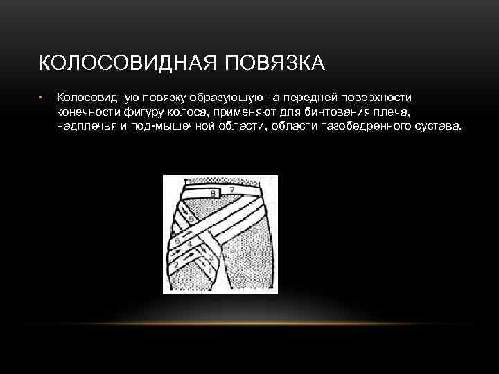 КОЛОСОВИДНАЯ ПОВЯЗКА • Колосовидную повязку образующую на передней поверхности конечности фигуру колоса, применяют КОЛОСОВИДНАЯ ПОВЯЗКА • Колосовидную повязку образующую на передней поверхности конечности фигуру колоса, применяют