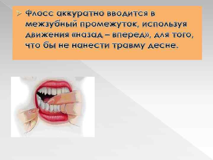 Ø Флосс аккуратно вводится в межзубный промежуток, используя движения «назад – вперед» , для
