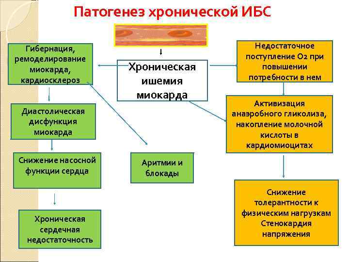   Патогенез хронической ИБС  Гибернация,      Недостаточное ремоделирование