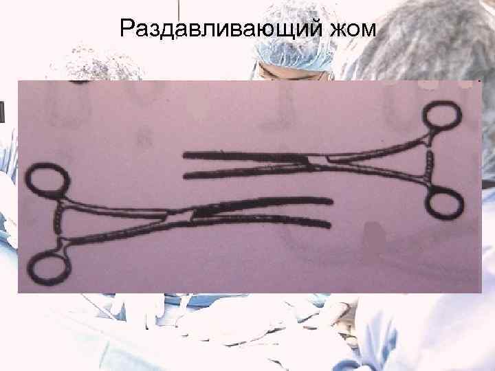 Раздавливающий жом 