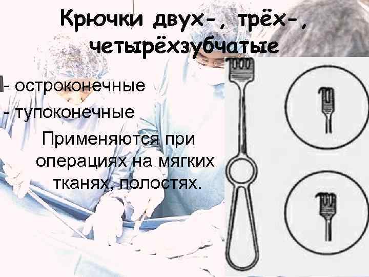  Крючки двух-, трёх-,   четырёхзубчатые - остроконечные - тупоконечные Применяются при операциях