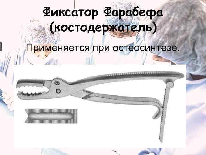   Фиксатор Фарабефа (костодержатель) Применяется при остеосинтезе. 