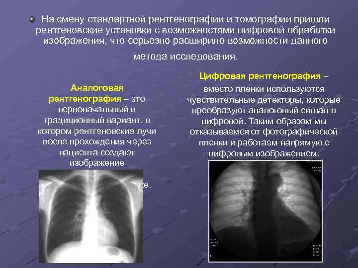 Рентгенография и рентгеноскопия