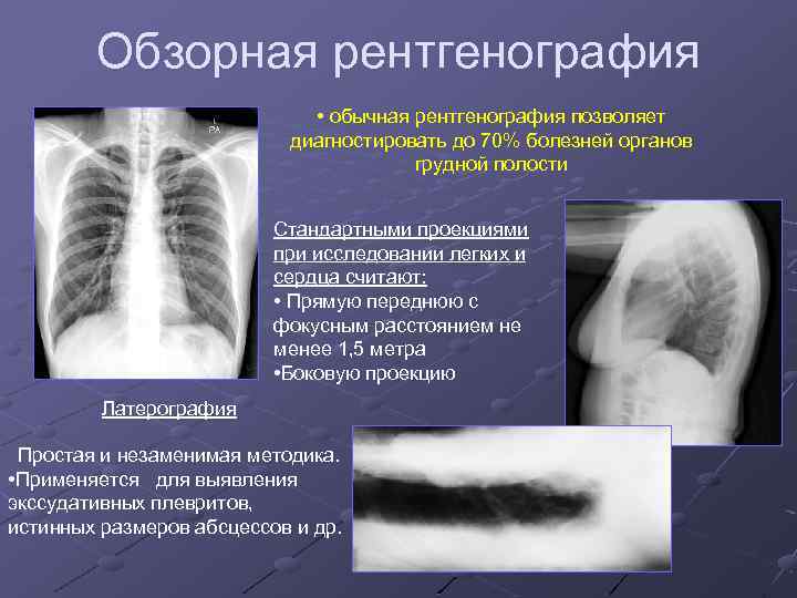 Планарное изображение рентгенография