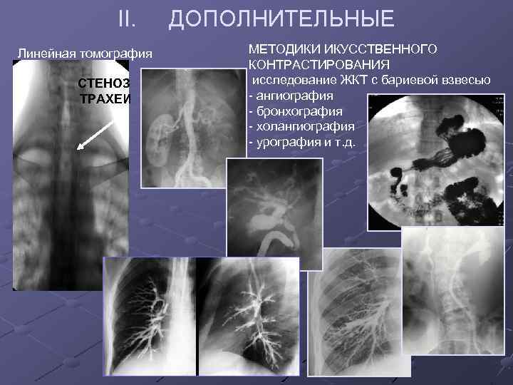 Несостоятельность трахеостомы карта вызова