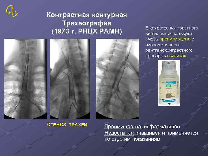 Контрастная контурная Трахеография (1973 г. РНЦХ РАМН) СТЕНОЗ ТРАХЕИ В качестве контрастного вещества используют