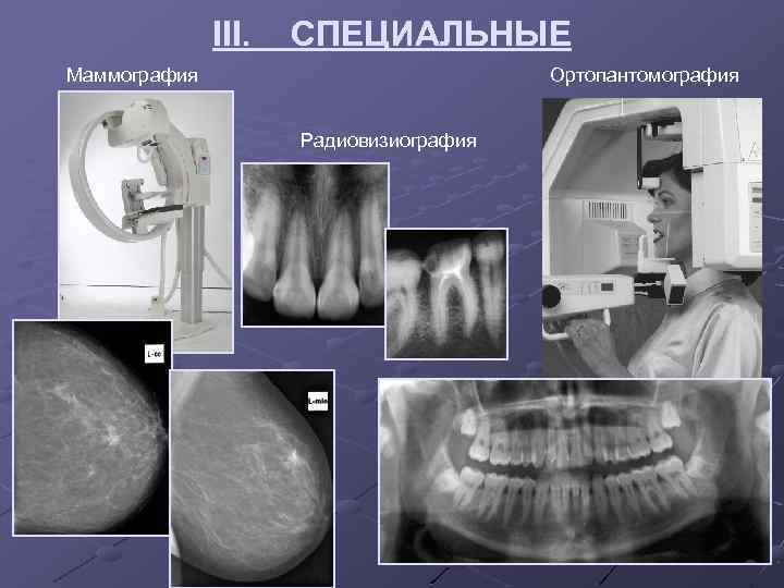 III. СПЕЦИАЛЬНЫЕ Маммография Ортопантомография Радиовизиография 