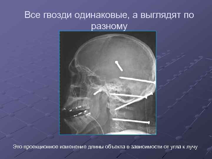 Все гвозди одинаковые, а выглядят по разному Это проекционное изменение длины объекта в зависимости