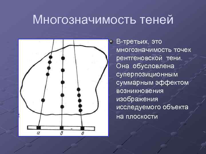 Многозначимость теней В-третьих, это многозначимость точек рентгеновской тени. Она обусловлена суперпозиционным суммарным эффектом возникновения