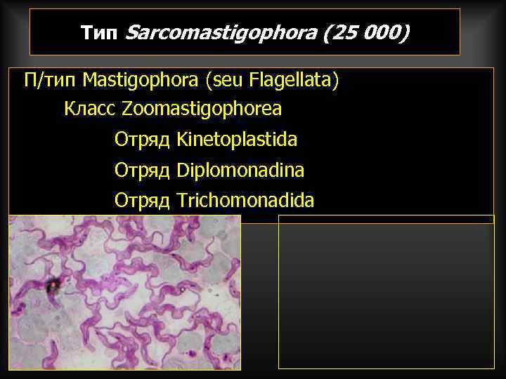  Тип Sarcomastigophora (25 000) П/тип Mastigophora (seu Flagellata) Класс Zoomastigophorea  Отряд Kinetoplastida