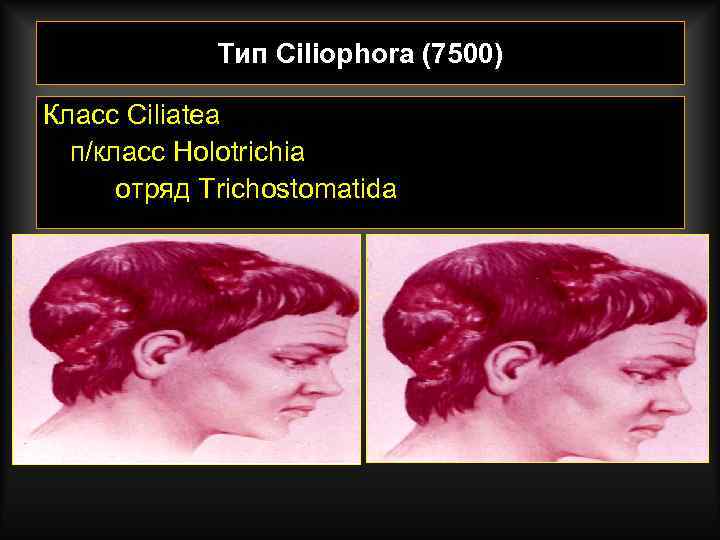    Тип Ciliophora (7500) Класс Ciliatea  п/класс Holotrichia  отряд Trichostomatida