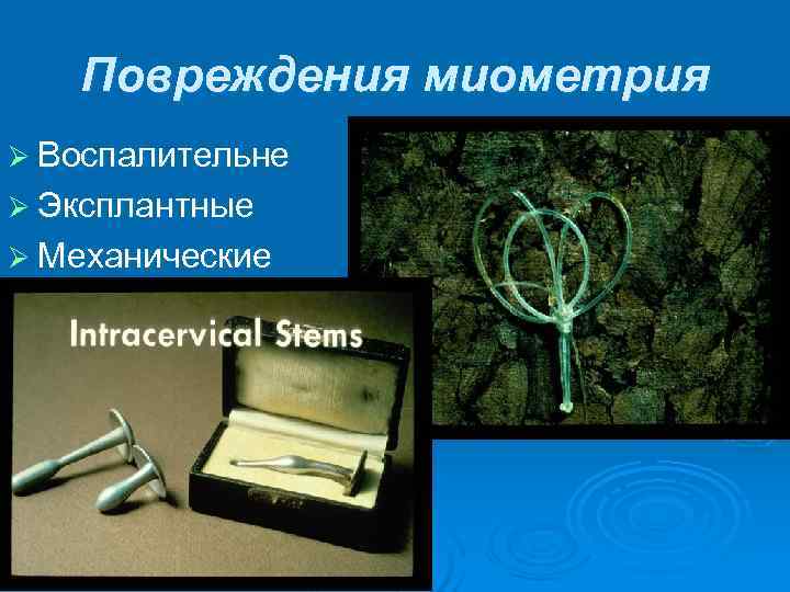   Повреждения миометрия Ø Воспалительне Ø Эксплантные Ø Механические 