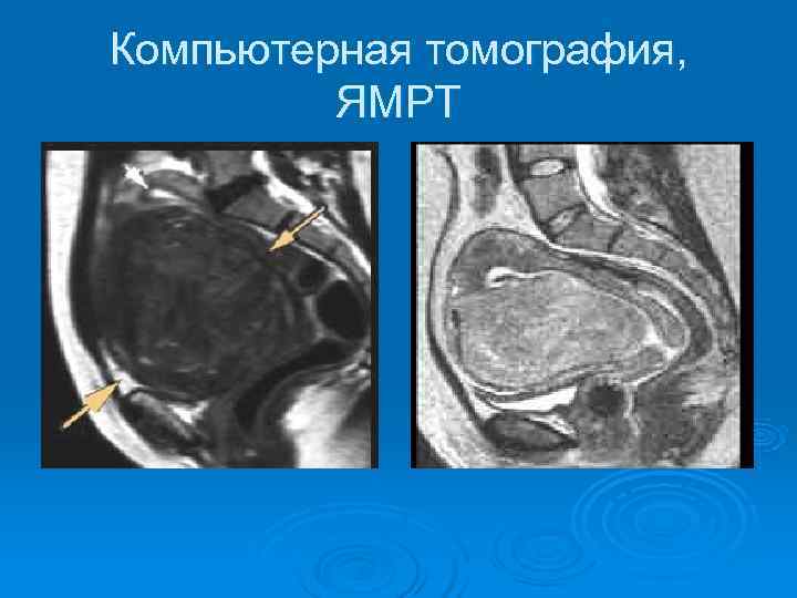 Компьютерная томография,  ЯМРТ 