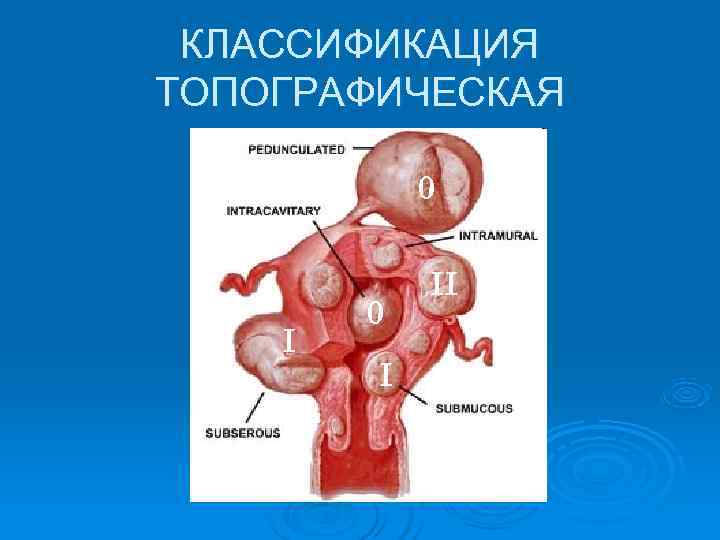  КЛАССИФИКАЦИЯ ТОПОГРАФИЧЕСКАЯ   0   II   0 I 