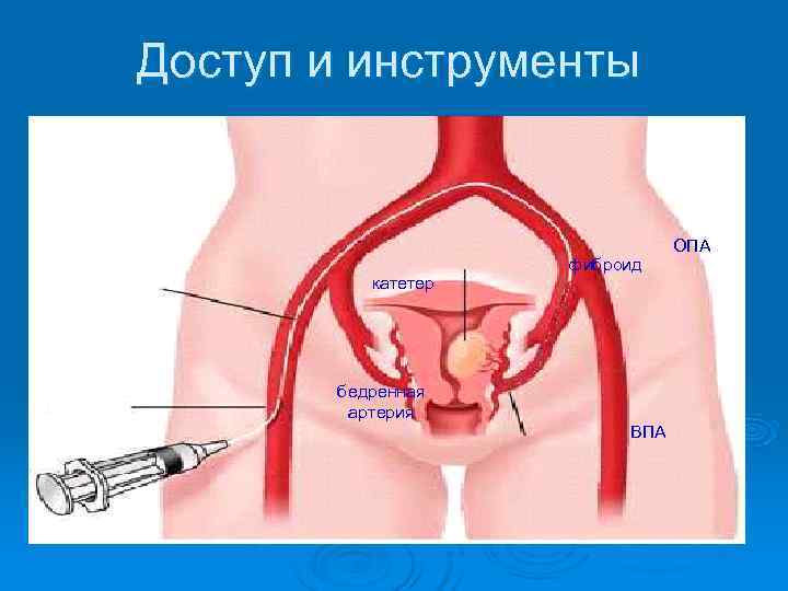 Доступ и инструменты    ОПА     ПБА  