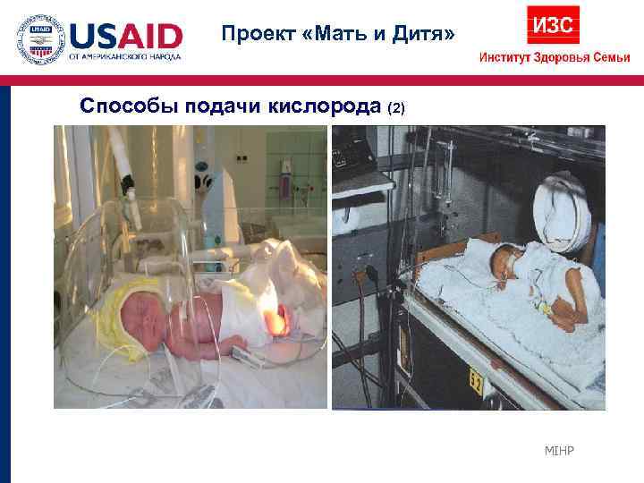   Проект «Мать и Дитя»  Способы подачи кислорода (2)   