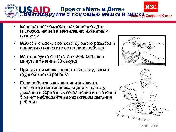     Проект «Мать и Дитя»  Вентилируйте с помощью мешка и