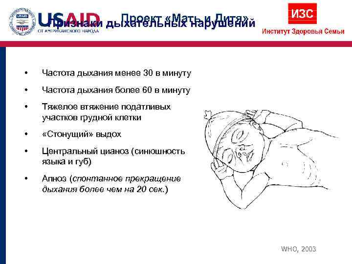     Проект «Мать и Дитя»  Признаки дыхательных нарушений • 