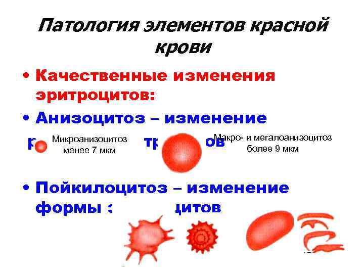 Морфологические изменения в эритроцитах рисунок