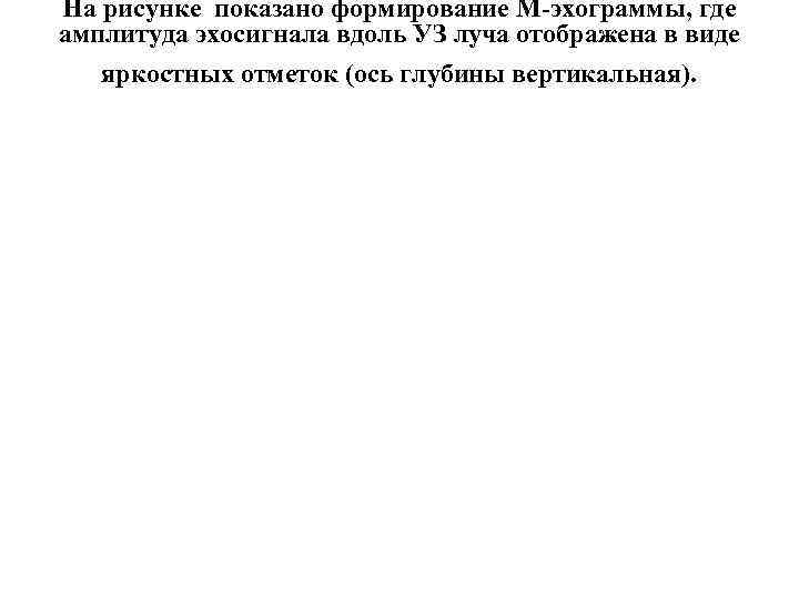 На рисунке показано формирование М-эхограммы, где амплитуда эхосигнала вдоль УЗ луча отображена в виде