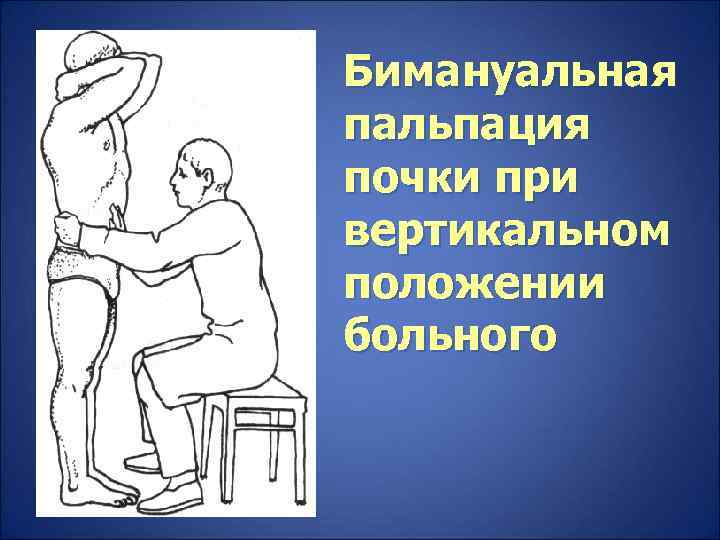 Бимануальная пальпация почки при вертикальном положении больного 