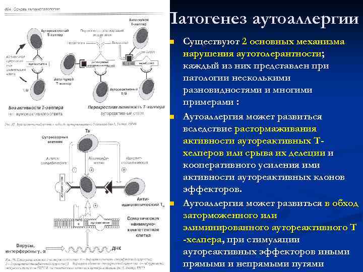 Патогенез аутоаллергии n  Существуют 2 основных механизма нарушения аутотолерантности; каждый из них представлен