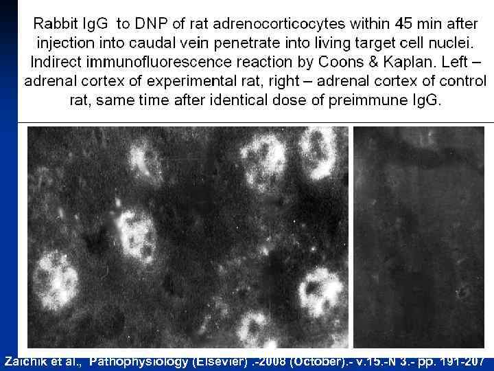 Zaichik et al. , Pathophysiology (Elsevier). -2008 (October). - v. 15. -N 3. -