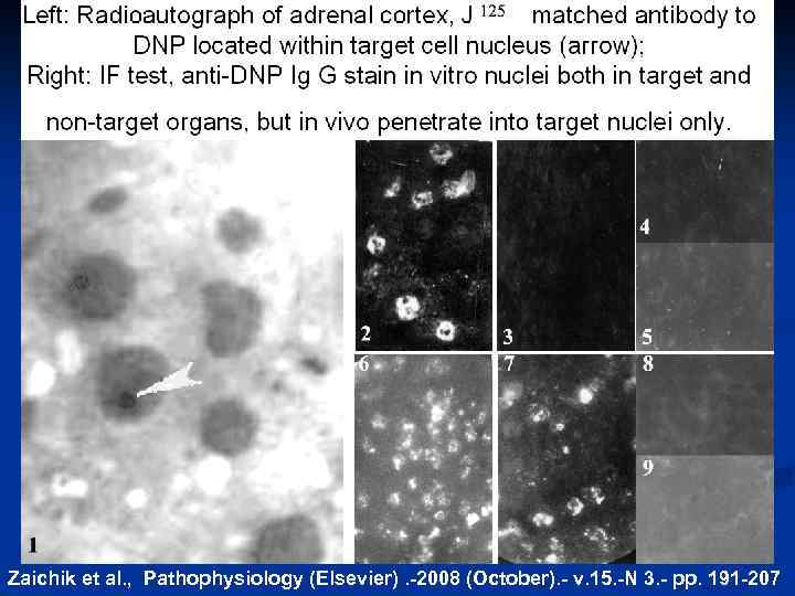 Zaichik et al. , Pathophysiology (Elsevier). -2008 (October). - v. 15. -N 3. -