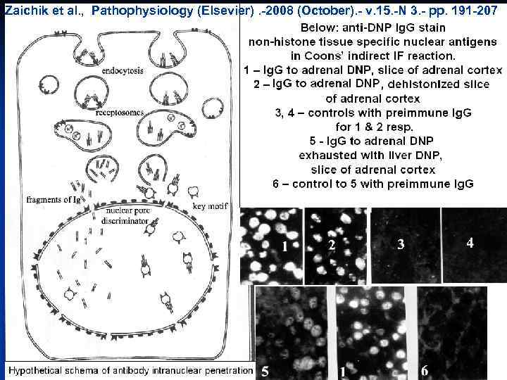 Zaichik et al. , Pathophysiology (Elsevier). -2008 (October). - v. 15. -N 3. -