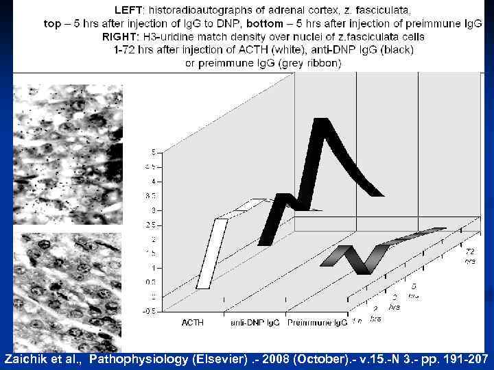 Zaichik et al. , Pathophysiology (Elsevier). - 2008 (October). - v. 15. -N 3.