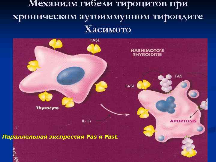 Общая схема патогенеза аутоаллергии 