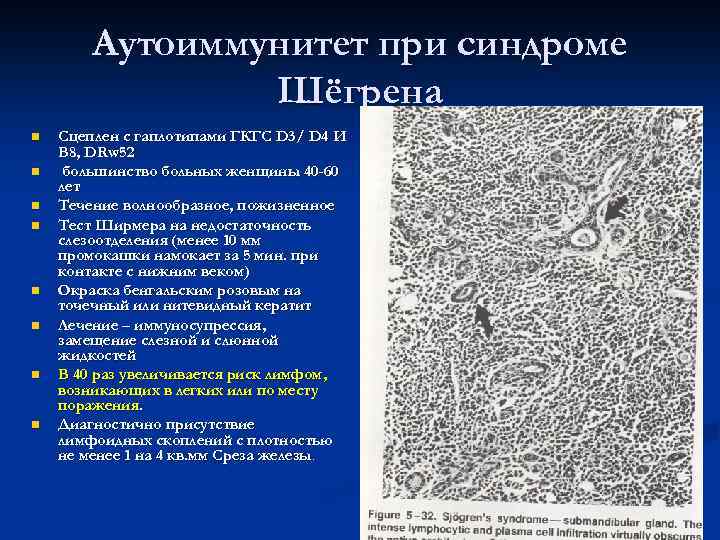  Височный (краниальный гигантоклеточный) артериит (болезнь   Хортона) n  аутоаллергический генерализованный или
