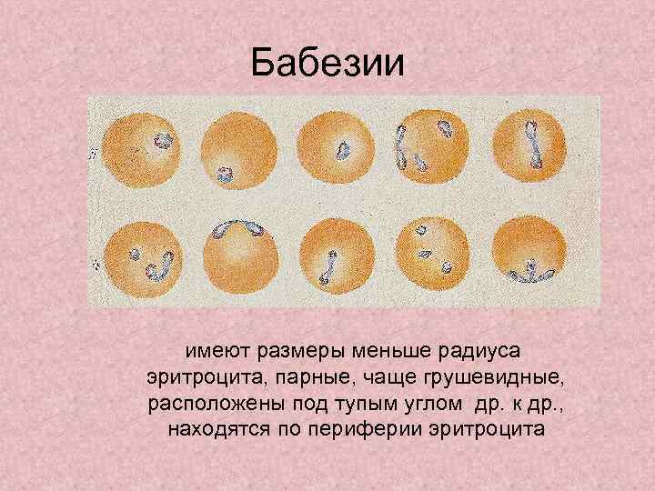    Бабезии  имеют размеры меньше радиуса эритроцита, парные, чаще грушевидные, расположены